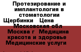 Протезирование и имплантология в стоматологии Щербинки › Цена ­ 15 000 - Московская обл., Москва г. Медицина, красота и здоровье » Медицинские услуги   
